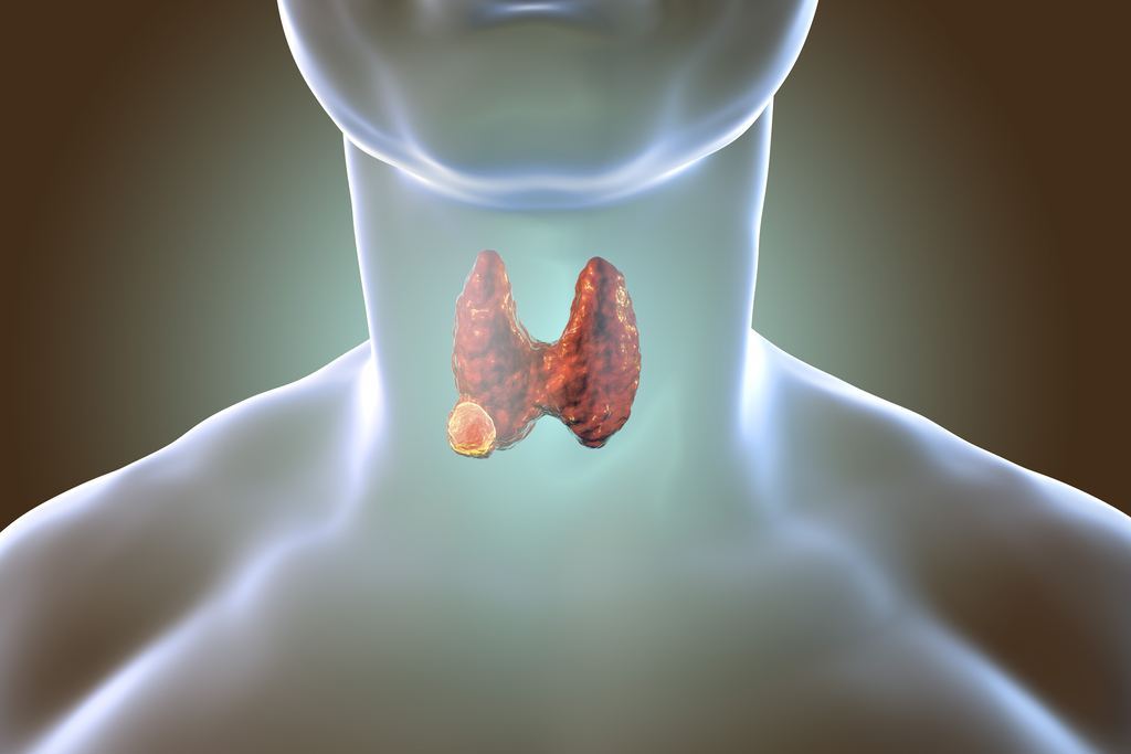 Токсическая аденома щитовидной железы